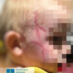 Багатодітну матір у Запоріжжі підозрюють у тортурах малолітнього сина ФОТО