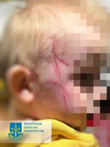 Багатодітну матір у Запоріжжі підозрюють у тортурах малолітнього сина ФОТО